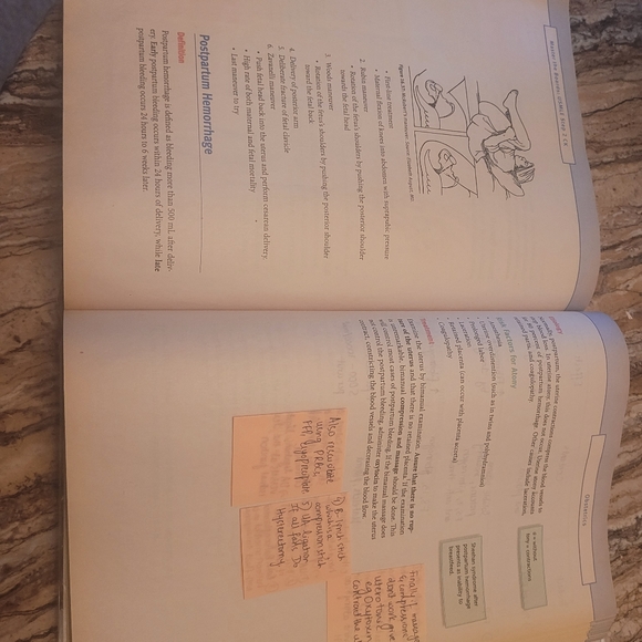 MTB STEP 2 - Picture 4 of 5